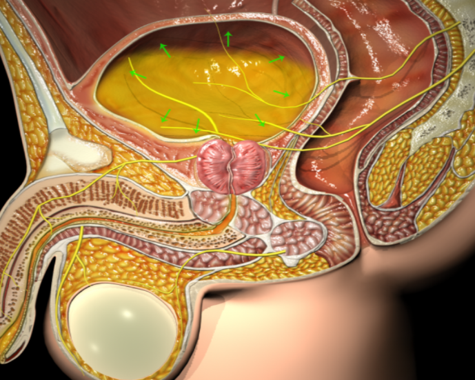 Strain on the bladder